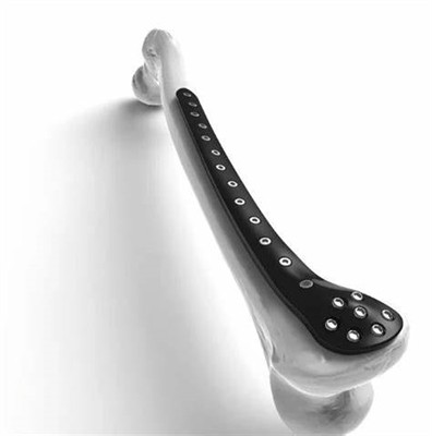 Applications of carbon fiber materials in the high-end medical and implant industries